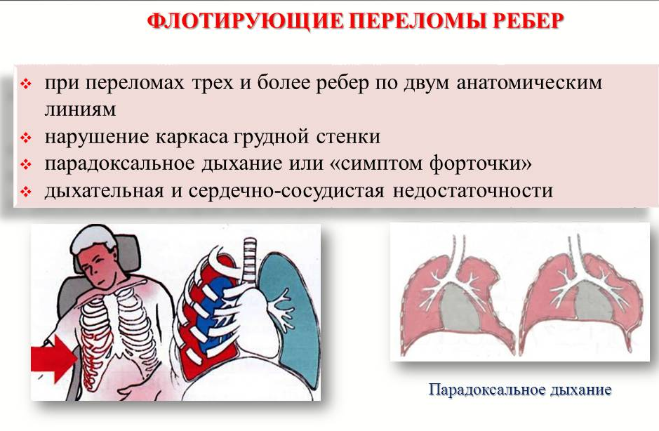 Причины повышения температуры при переломе