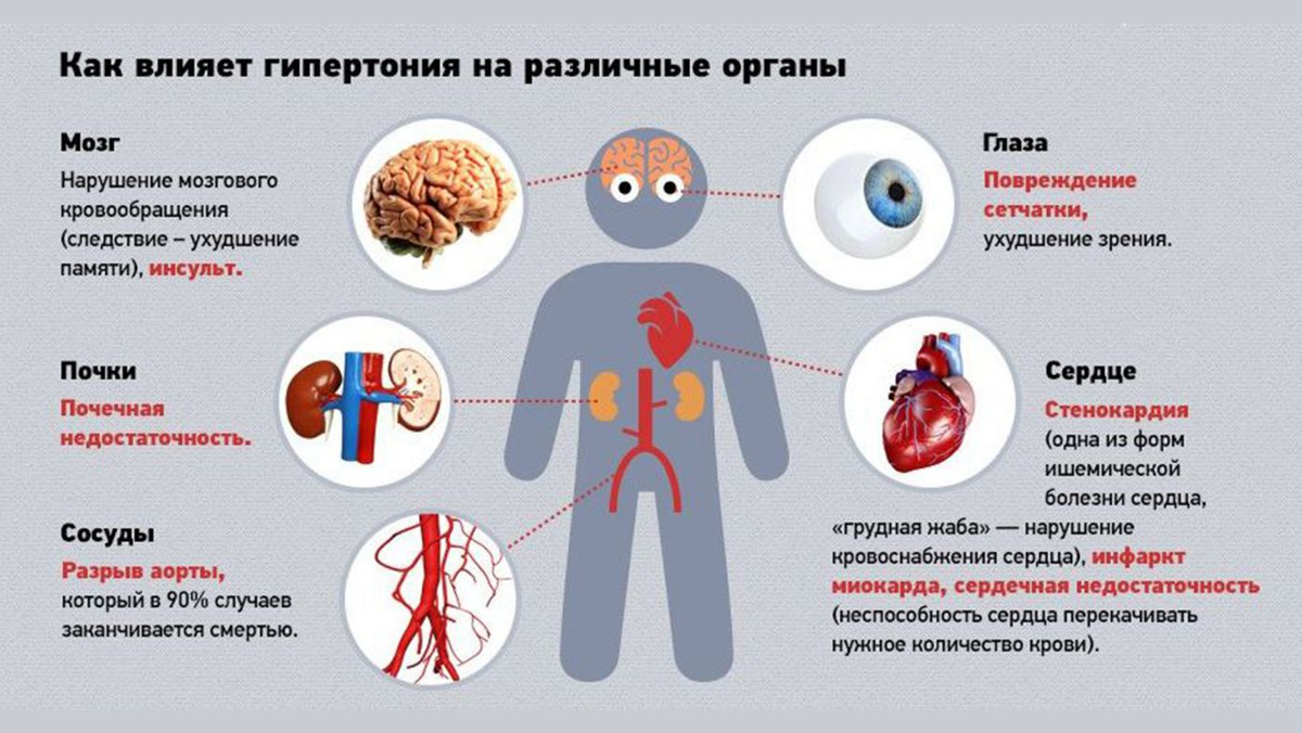 Гипертония у детей: причины, симптомы, норма и лечение