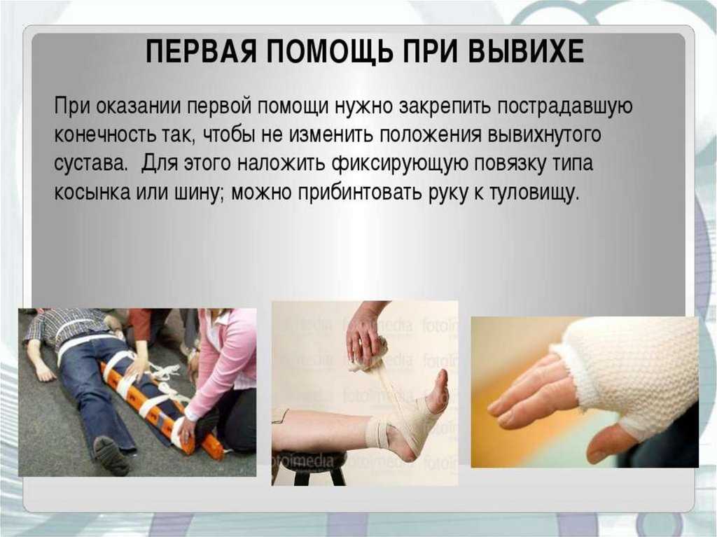 Первая помощь при вывихе: что делать до прихода врача | мрикрнц.рф