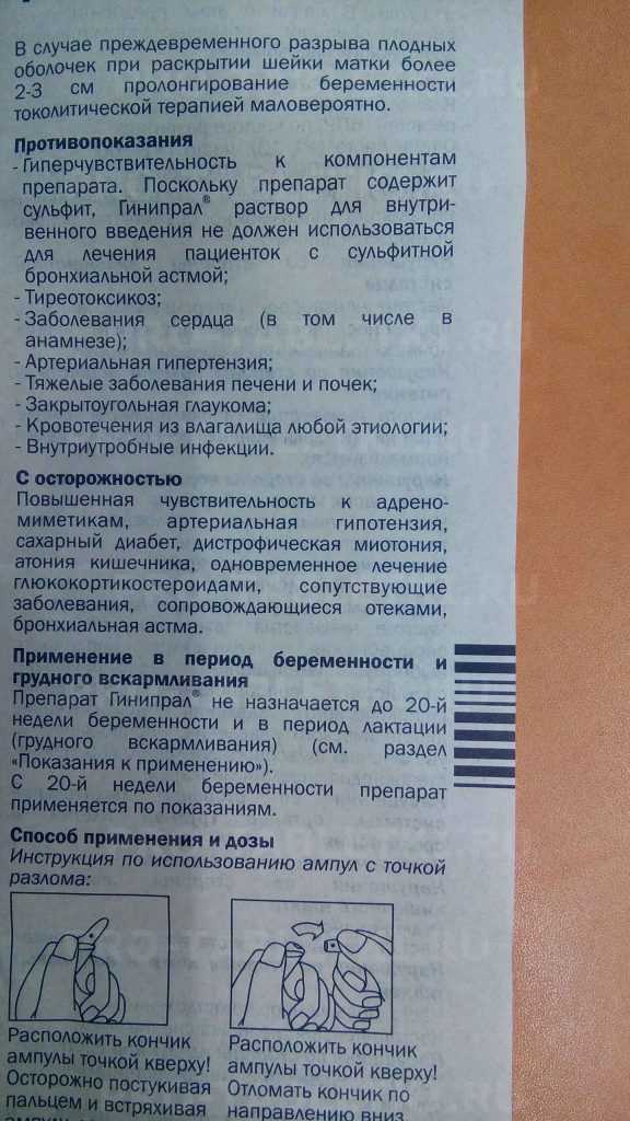 Какие бывают капельницы во время беременности. для чего назначают капельницы при беременности и можно ли от них отказаться