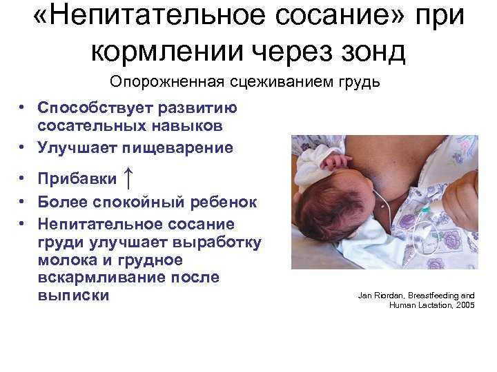 Методика установки транспилорического зонда у новорожденного