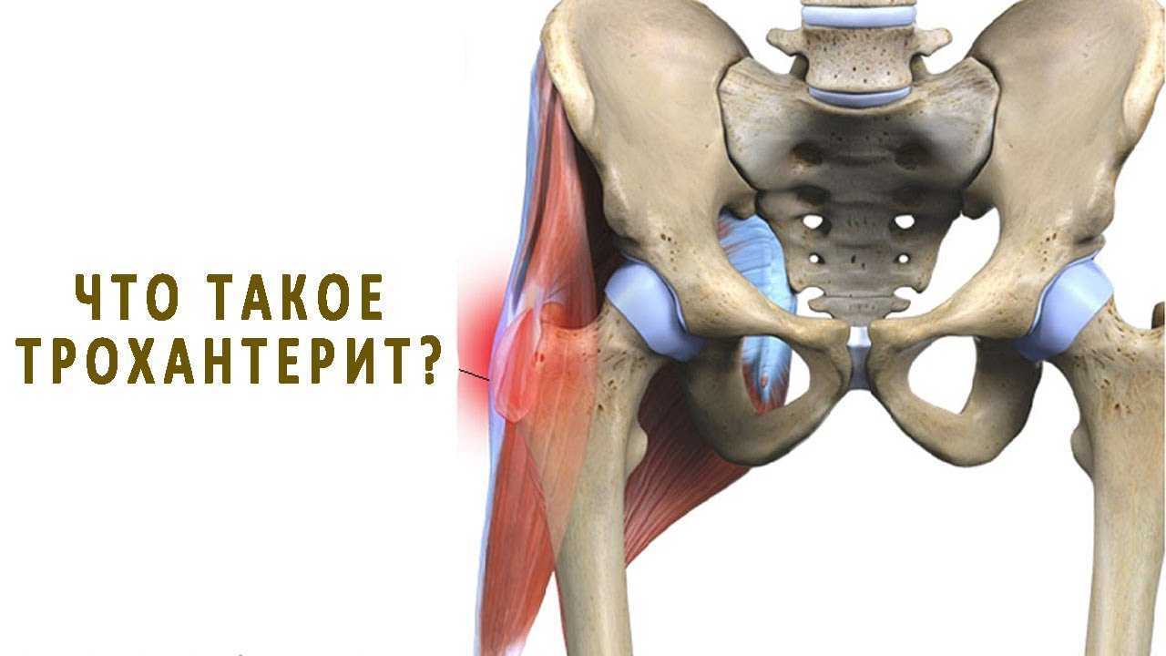 Симптоматика и лечение остеохондроза тазобедренного сустава