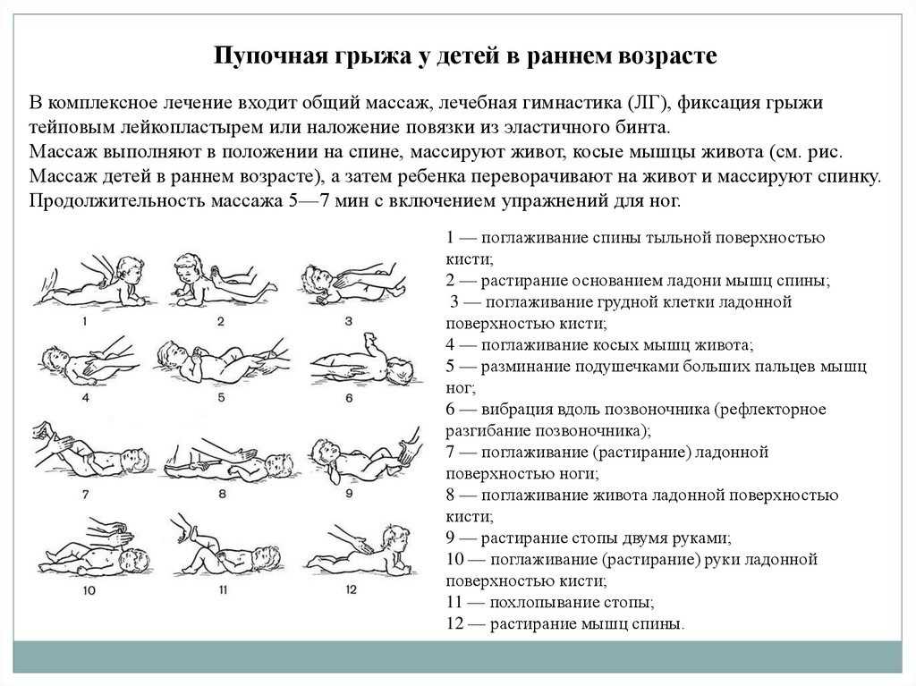 Последствия после операции по удалению пупочной грыжи
