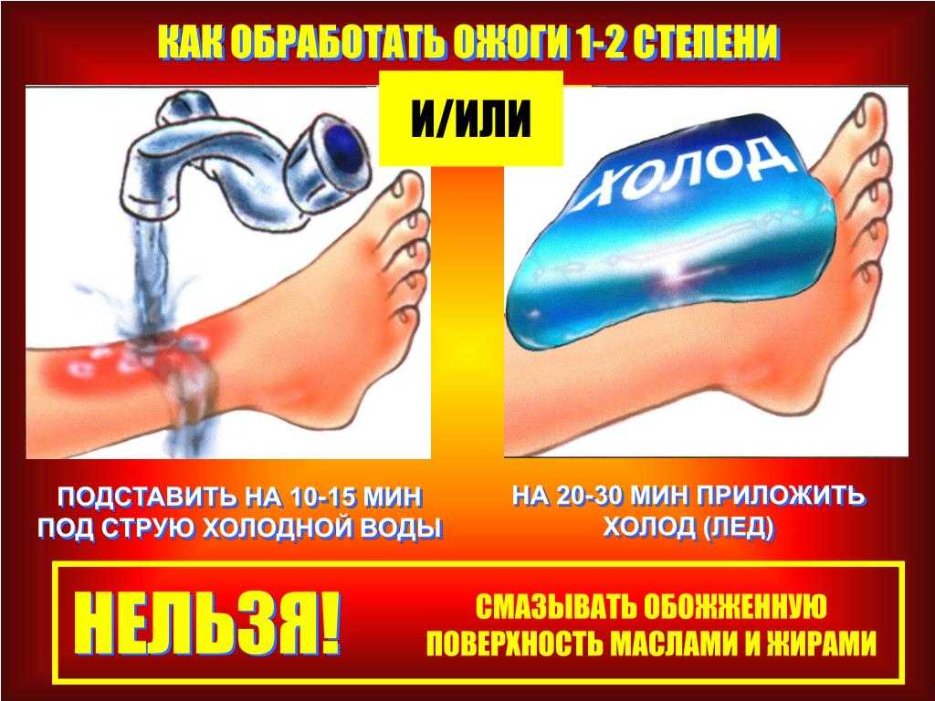 Что делать при химическом ожоге кожи, глаз, жкт: первая помощь и лечение