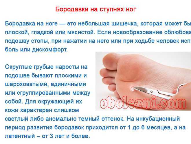 Вот как вывести бородавку в домашних условиях 9 быстрых способов - здравие - блог захара журавлева