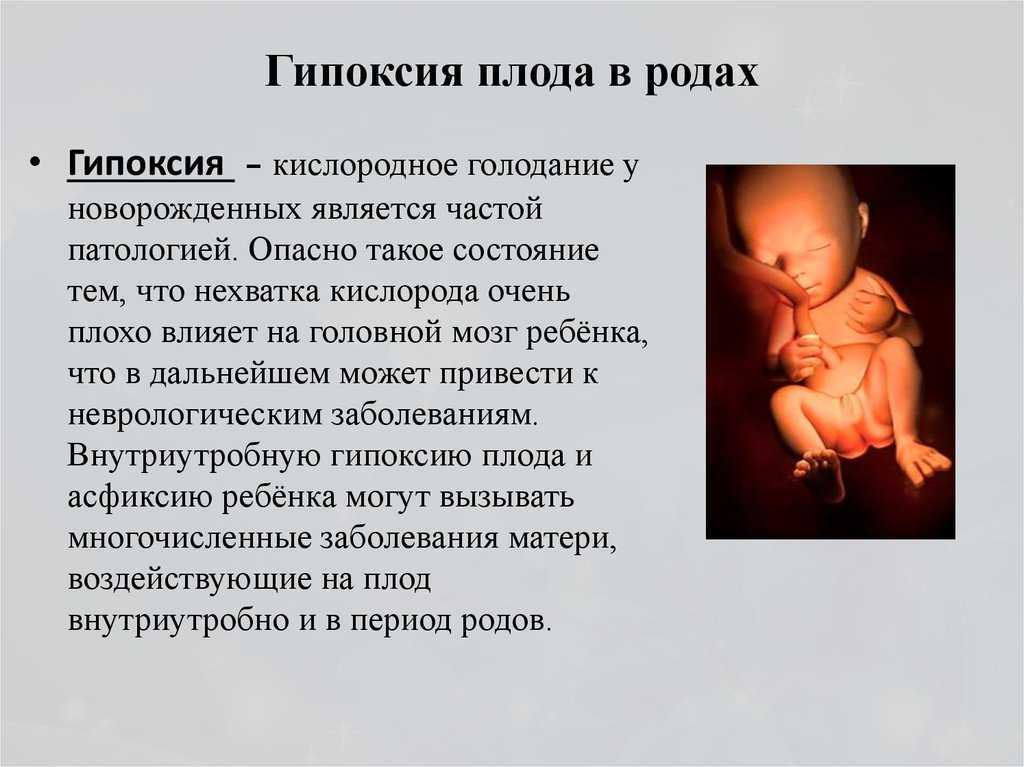Гипоксия плода во время беременности и при родах: чем опасна, ее признаки, лечение и профилактика
