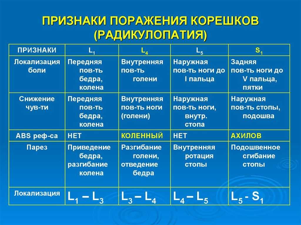 Грудной остеохондроз