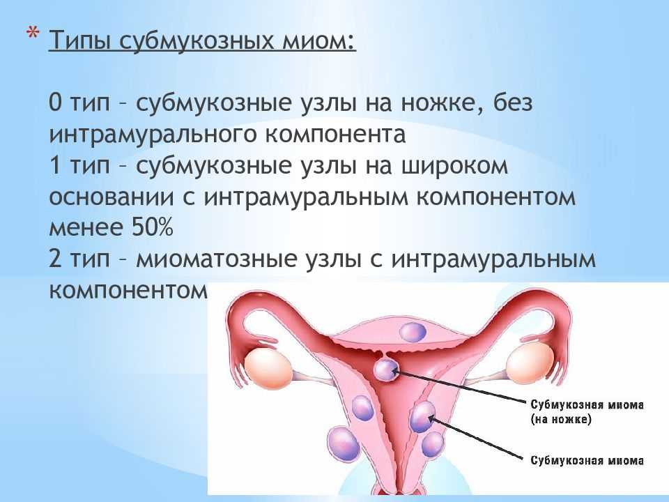 Реабилитация после удаления миомы матки - медицинская статья от специалистов центра реабилитации благополучие