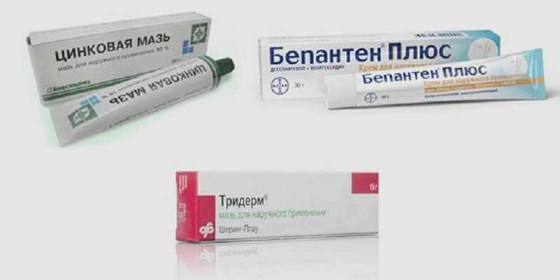 Покраснение вокруг ануса у ребенка | moninomama.ru