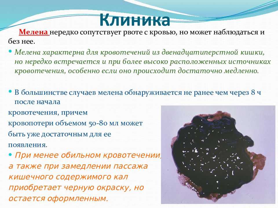 Кал черный (темного цвета) при алкоголизме