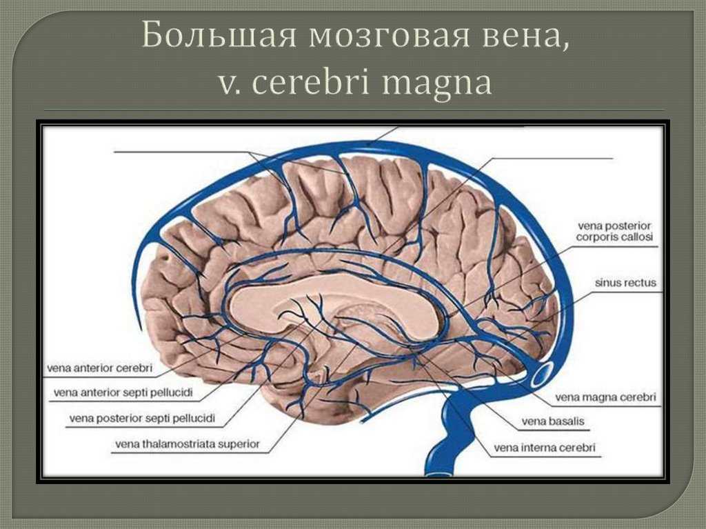 Опасный тромбоз мозговых синусов: что нужно знать