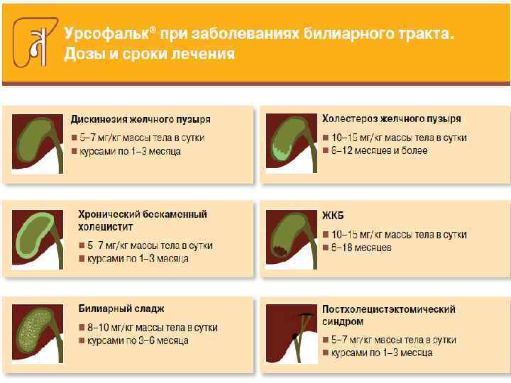 Что такое перегиб желчного пузыря