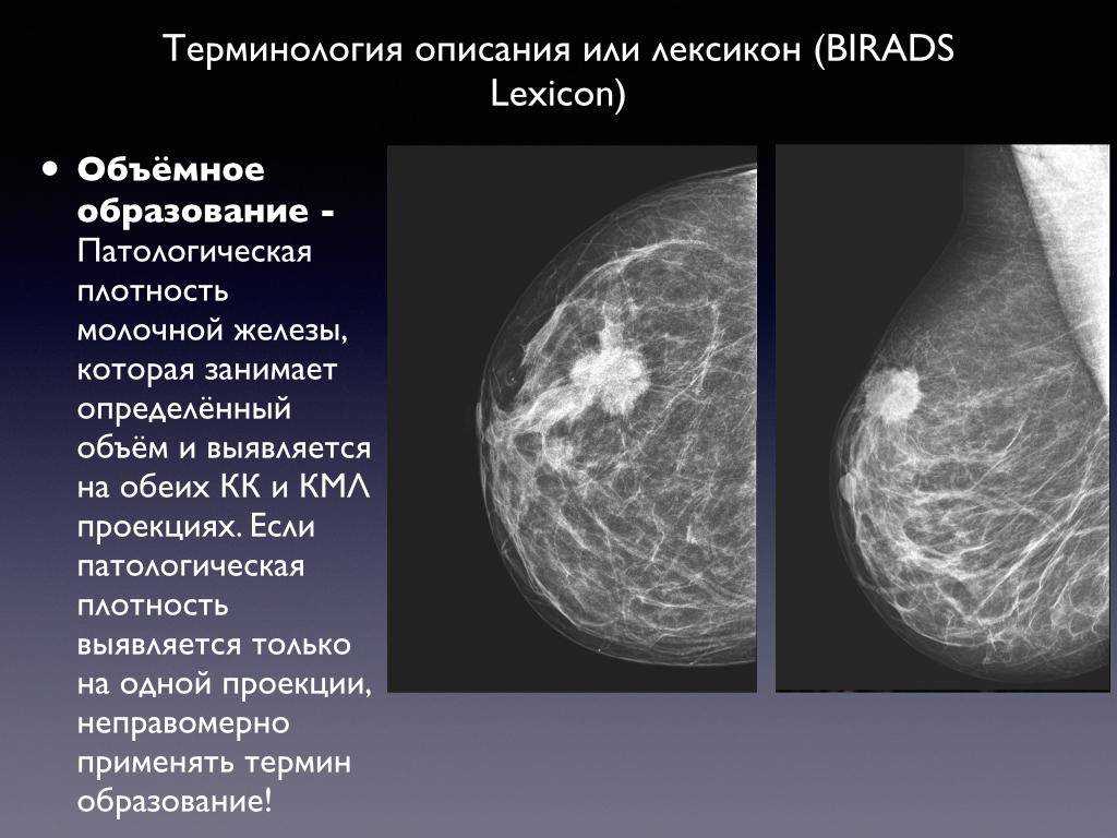Удаление доброкачественной опухоли молочной железы - описание услуги, при каких болезнях и какие врачи назначают
