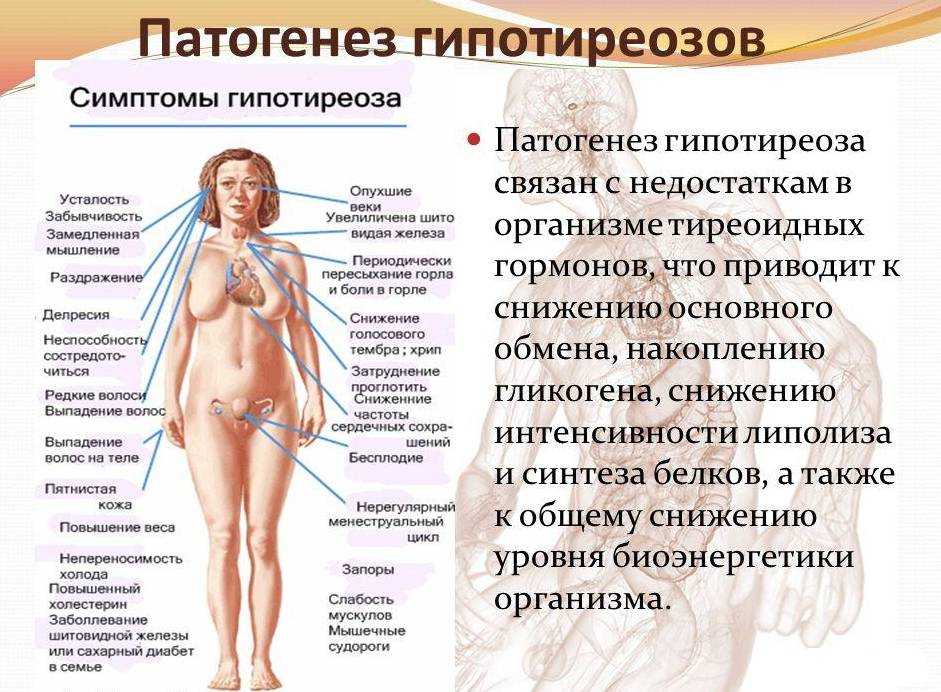 Гипотиреоз: народные средства и диета для лечения заболевания
гипотиреоз: народные средства и диета для лечения заболевания
