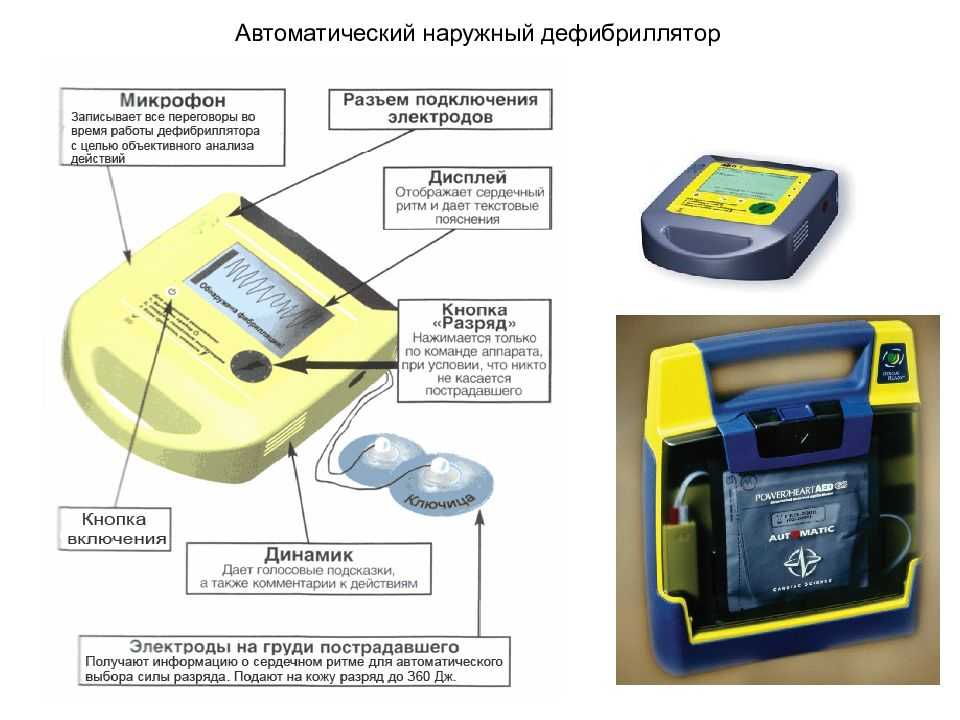 Как использовать дефибриллятор: 11 шагов