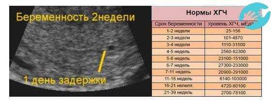 7 неделя беременности - что происходит с мамой и малышом? что можно увидеть на узи?