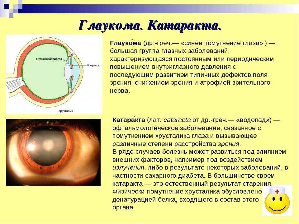 Можно ли вернуть зрение при глаукоме?
