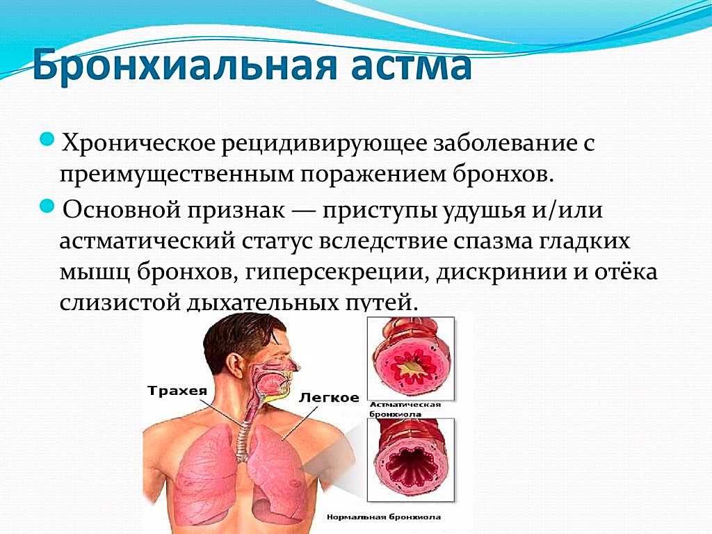 Бронхоспазм: что это, симптомы, причины, как снять | советы медика