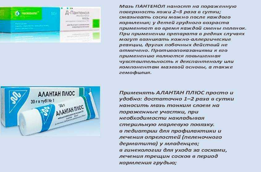 Потница