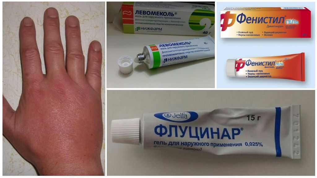Если укусила (поцарапала) бешеная кошка — что делать?