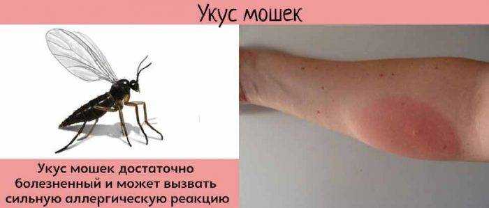 Укусы блох у детей: подробные фото и советы по лечению