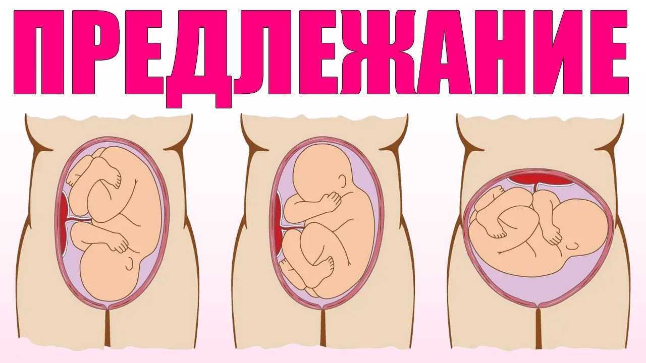 Крупный ребенок: хорошо или не очень?