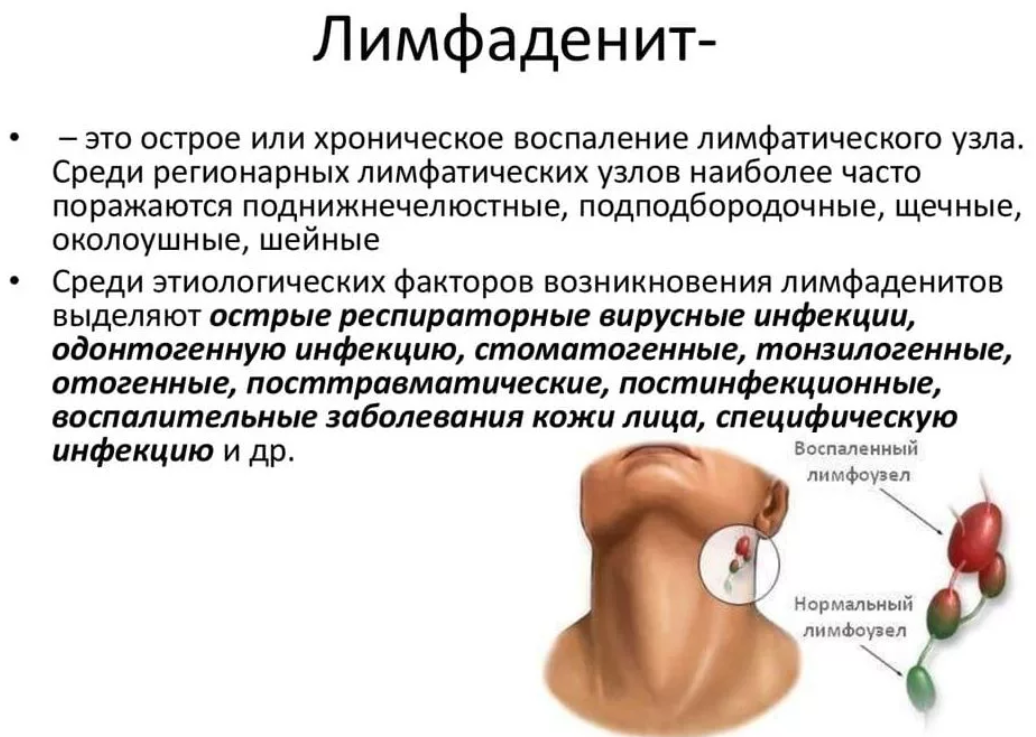 Ребенок потеет при температуре и после ее снижения - это хорошо