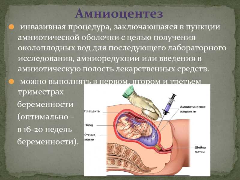 Амниоцентез, результаты, анализ, сроки