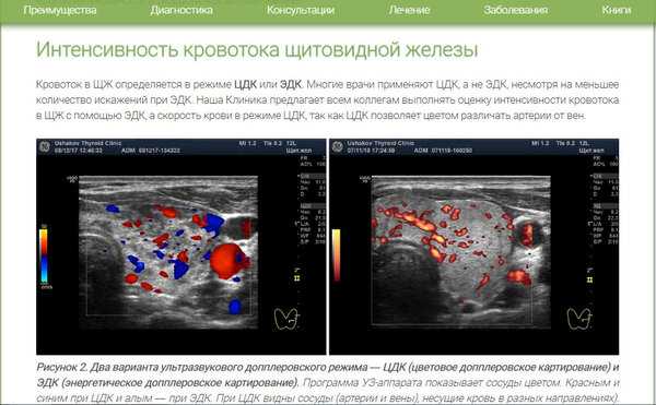 Допплерография - дуплексное исследование артерий и вен
