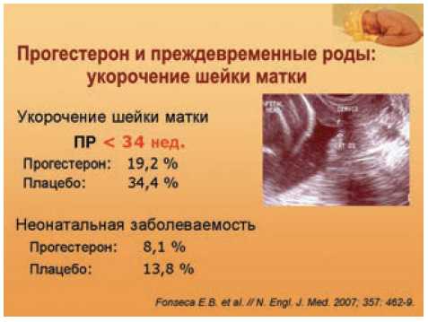 Длина шейки матки при беременности – таблица нормы по неделям, прогноз