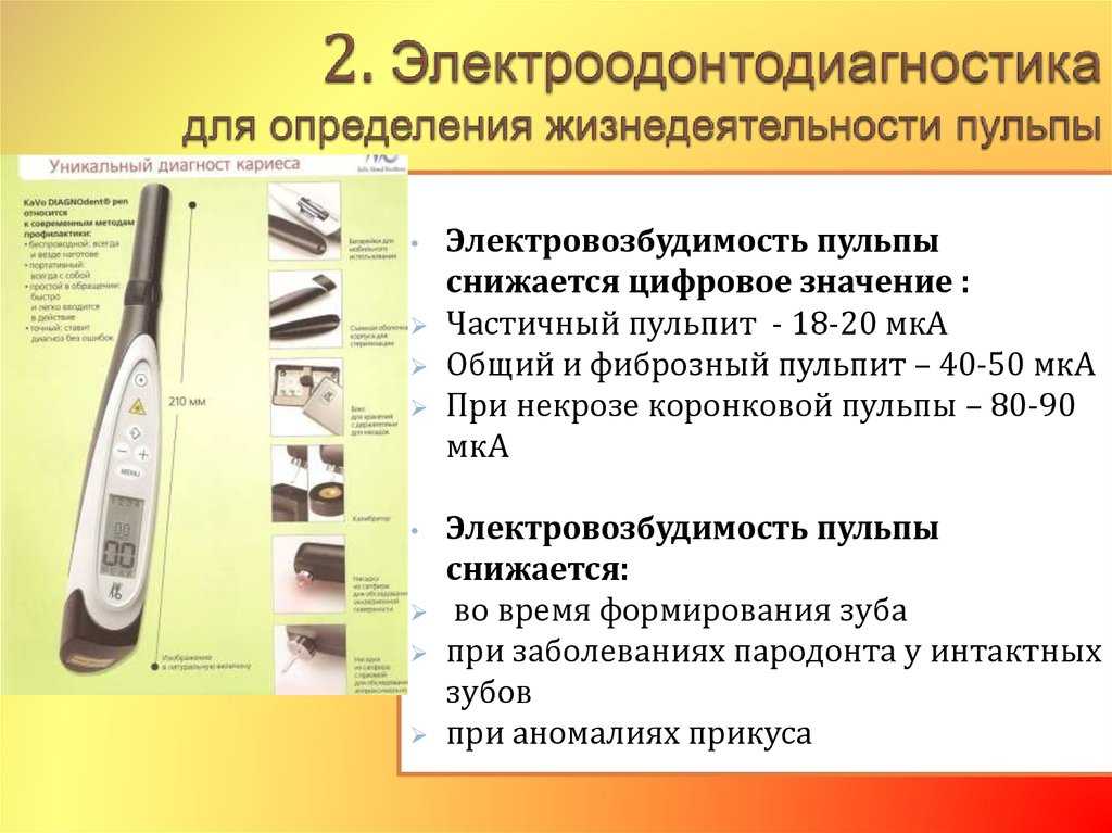 Электроодонтометрия — надежная диагностика жизнеспособности пульпы зуба