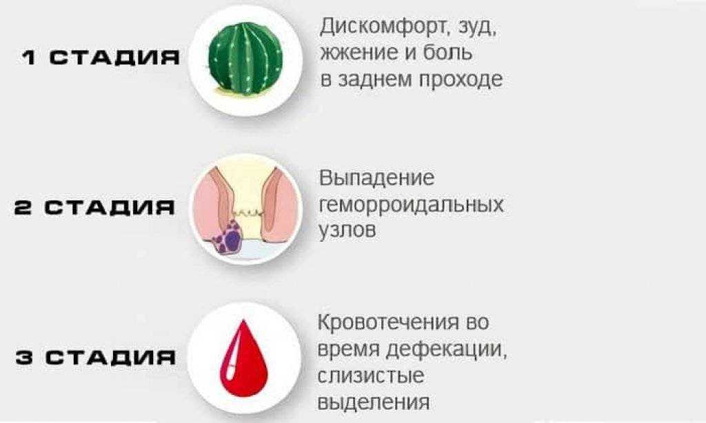 Вибрация в прямой кишке: причины и симптомы