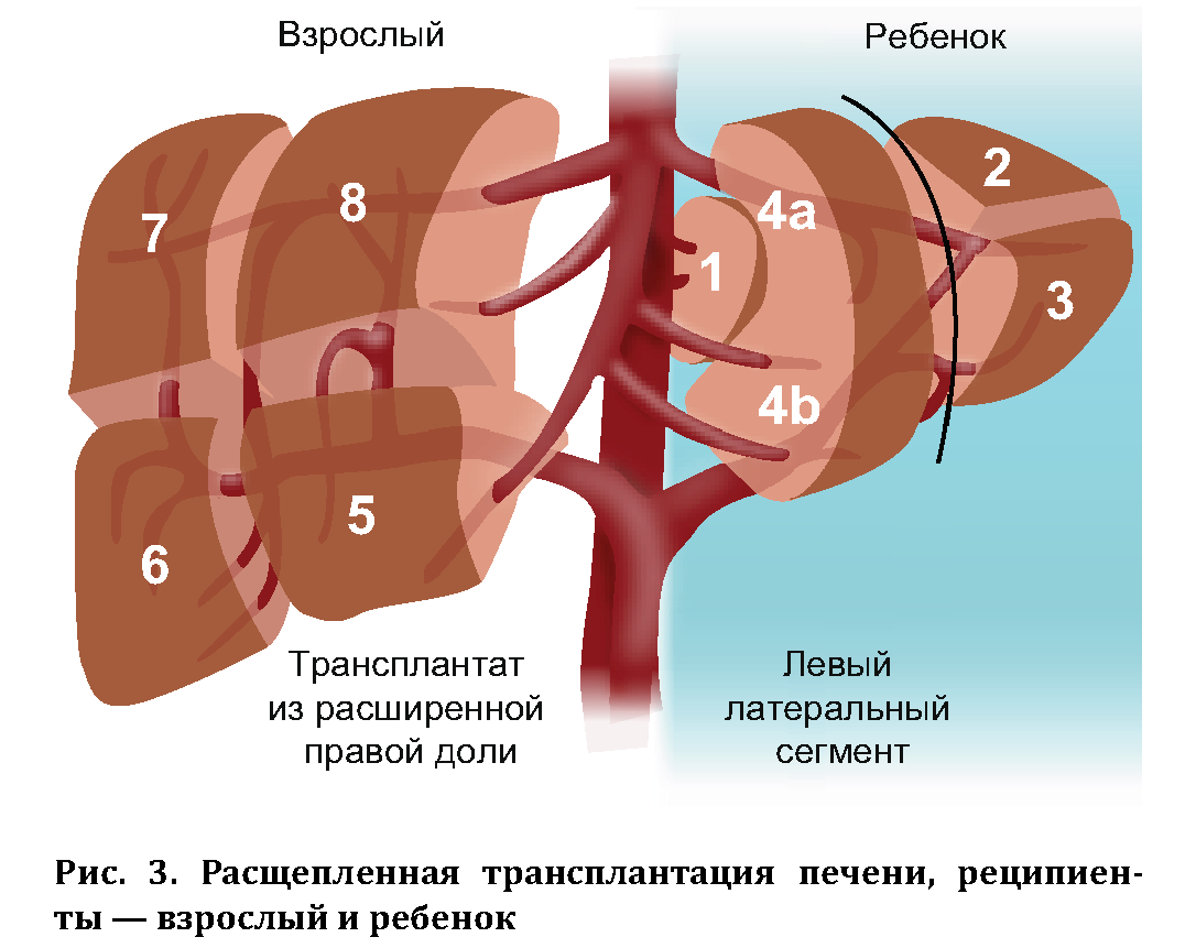 Трансплантация и пересадка печени: когда необходима и сколько стоит