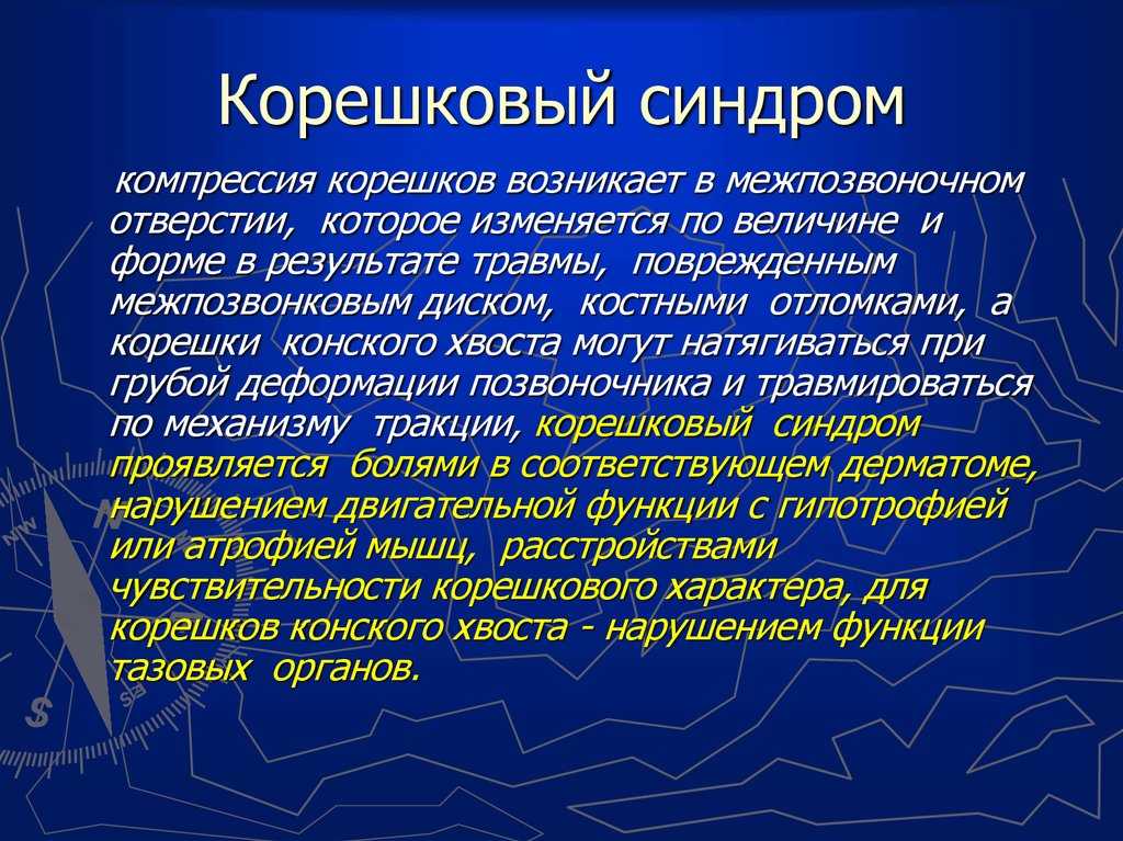 Воспаление нервных корешков грудного отдела позвоночника симптомы и лечение
