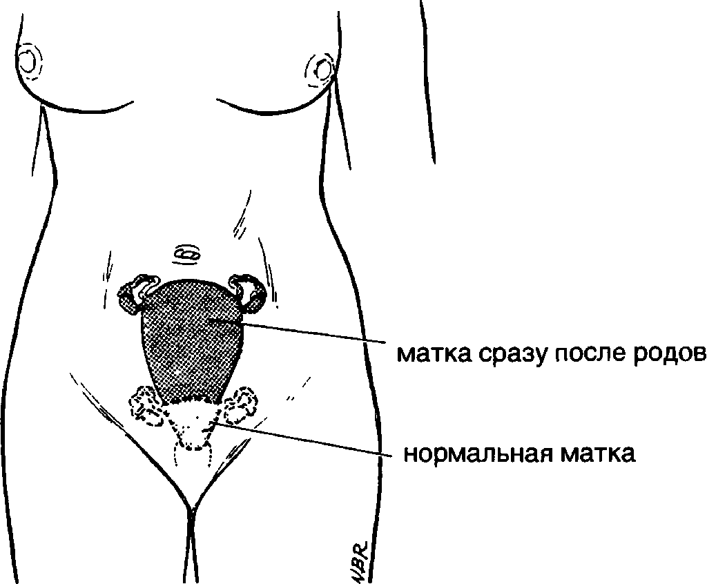 Субинволюция матки: почему не сокращается матка и чем это опасно * клиника диана в санкт-петербурге