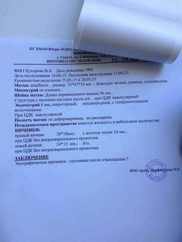 Выкидыш