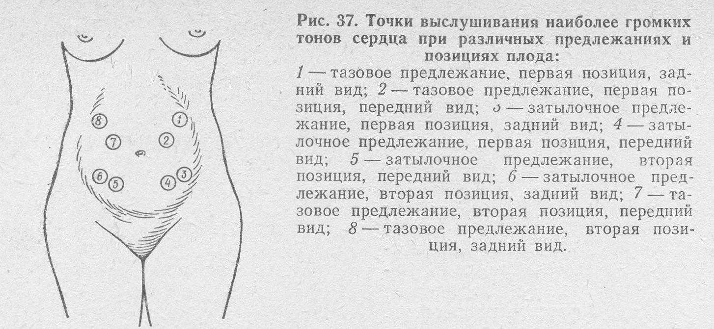 Сердцебиение плода по неделям: сводная таблица и можно ли определить пол ребенка по чсс на 12 или 20 неделе беременности?