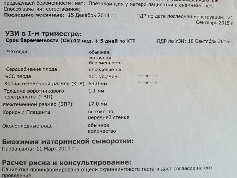 Узи плода