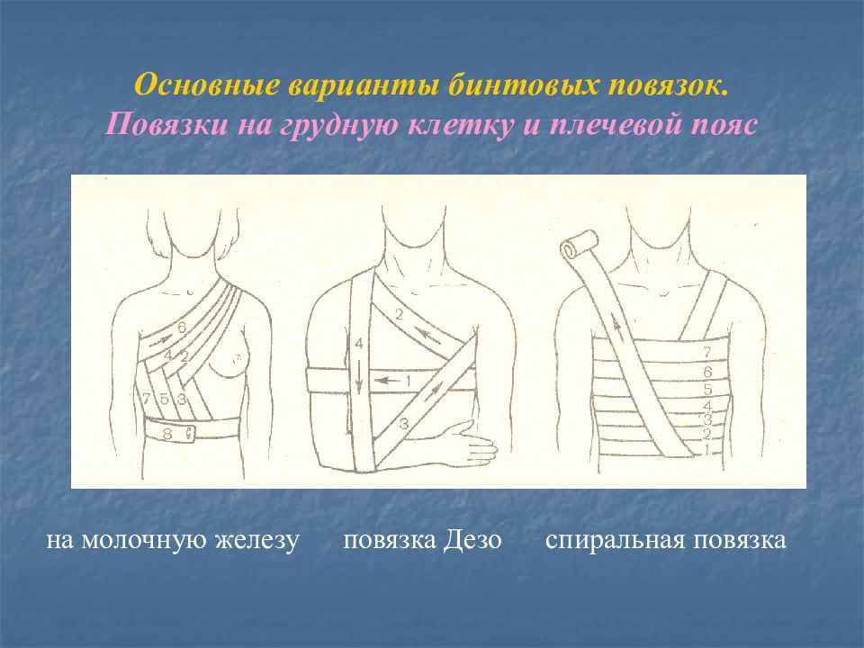 Повязки, накладываемые на грудную клетку
