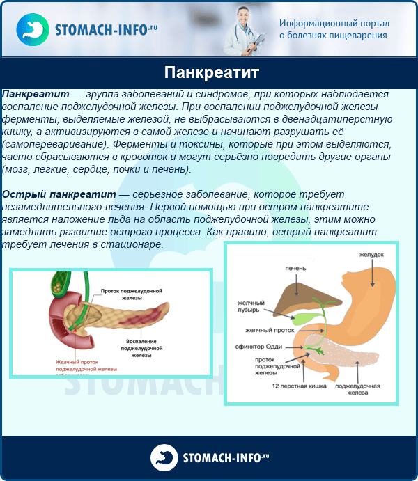 Панкреатит — что вызывает это заболевание? как его диагностировать и лечить? часть 1