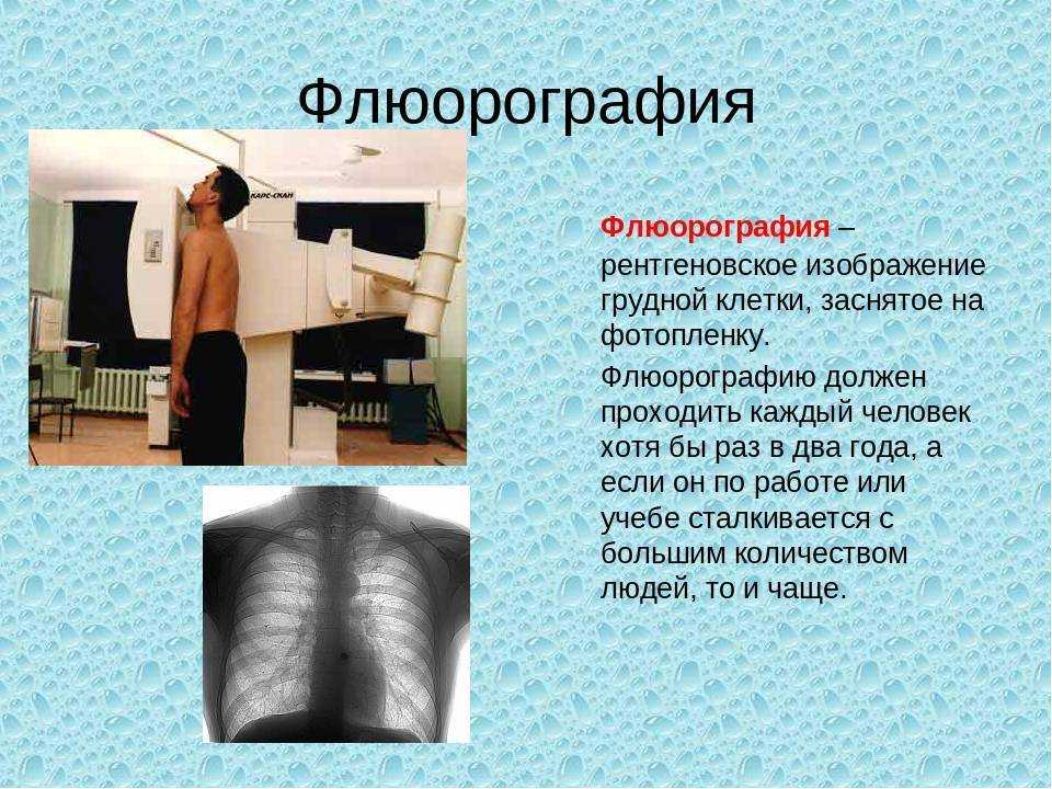 Флюорография - что показывает, как часто можно делать?