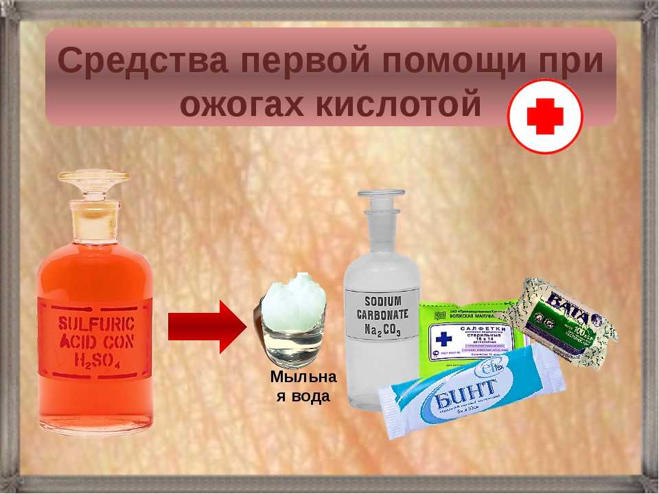 Какие мази от ожогов на коже помогают лучше?