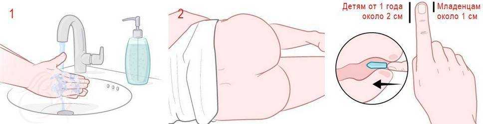 Как вставлять ректальные суппозитории - wikihow