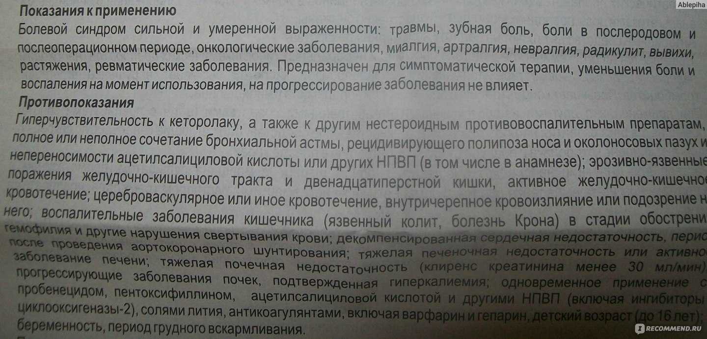 Кетанов от зубной боли