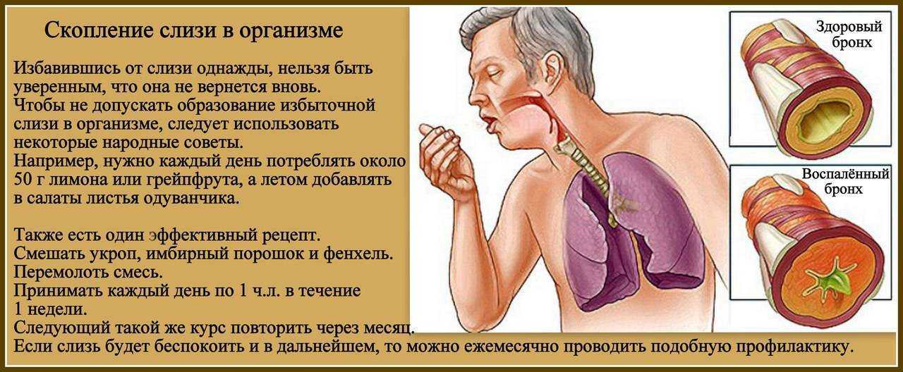 Что такое бронхоспазм?