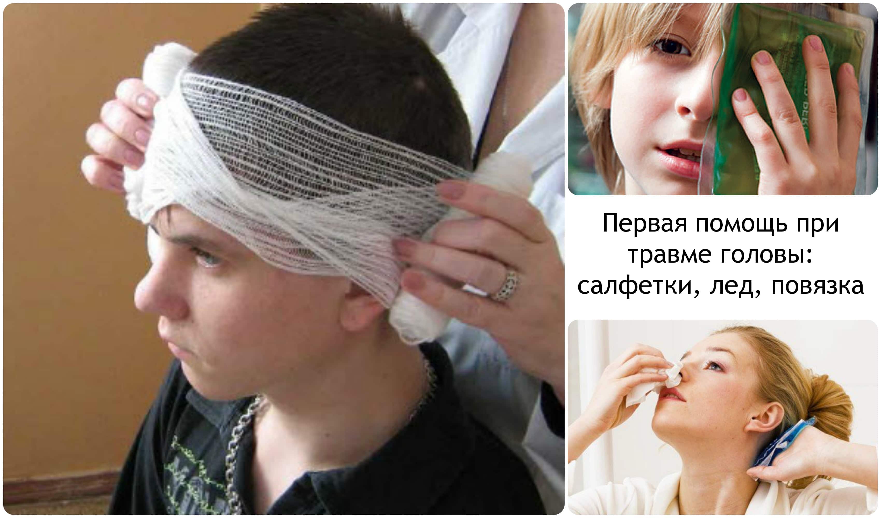 Препараты для стабилизации состояния пациента при сотрясении мозга