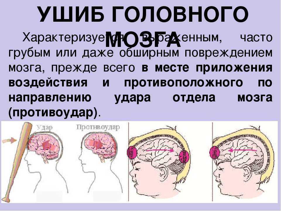 Что делать, если ребенок ударился головой: советы врача
