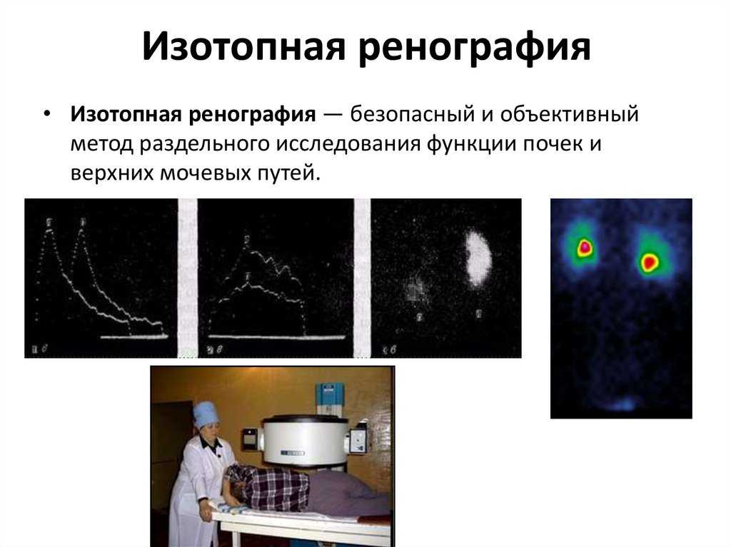Сцинтиграфия почек или радиоизотопное исследование