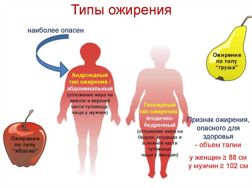 Алиментарное (пищевое, первичное) ожирение