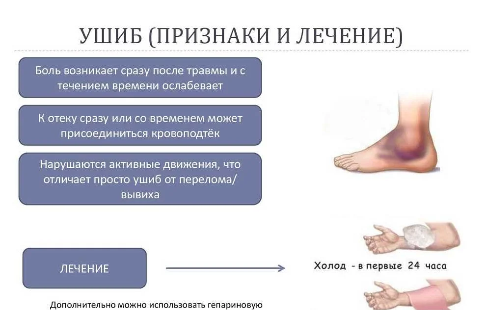 Ушиб лучезапястного сустава (запястья): первая помощь, лечение, реабилитация | мрикрнц.рф